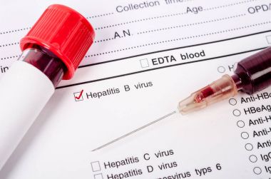 Dünya hepatit gün kavramı.