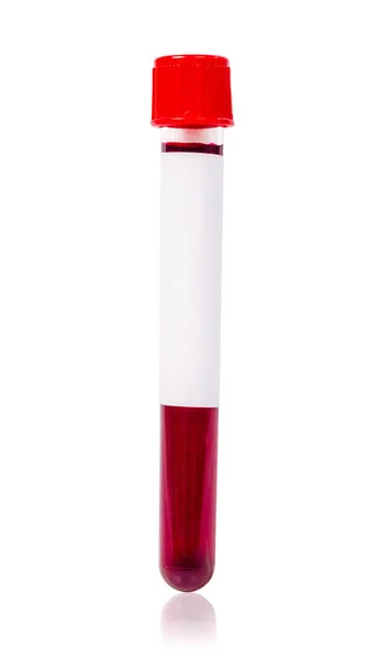 Prueba de tubo sanguíneo al vacío rojo con muestra de sangre . —  Fotos de Stock