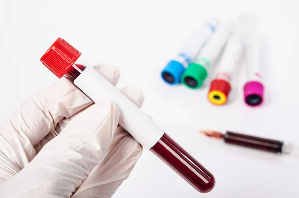 Hand holding test tube with blood plasma. — Stock Photo, Image