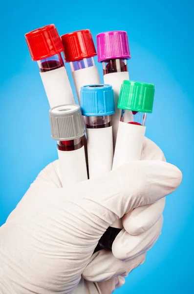 Tubos de vacío para recoger muestras de sangre en el laboratorio . — Foto de Stock