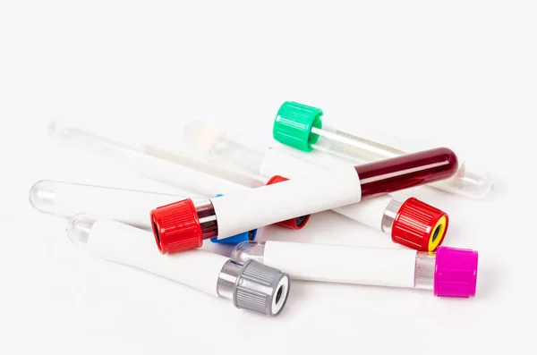 Vacuum blood tubes for collecting with blood samples. — Stock Photo, Image