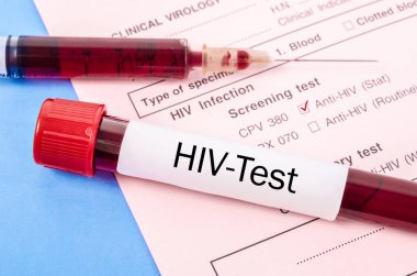 Örnek kan toplama tüp HIV testi ile.