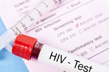 Örnek kan toplama tüp HIV testi ile.