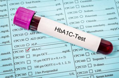 Hemoglobin A1c testi örnek kanla.