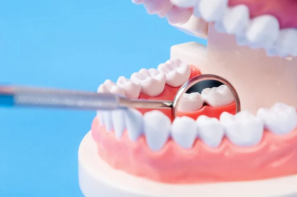 Caries dental dental en prótesis dentales con equipo . — Foto de Stock