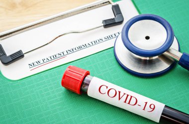 Yeni Corona virüsü enfeksiyonu (yeni Coronavirus hastalığı 2019) tanısı için yapılan kan testinin pozitif COVID-19 testi ve laboratuvar örneği. Bulaşıcı salgın konsepti.