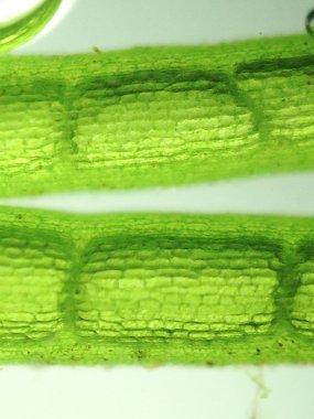 Yakınlaştırma mikroorganizma yosun