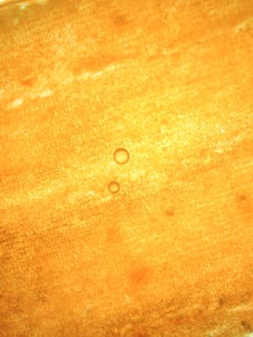 Yakınlaştırma mikroorganizma yosun