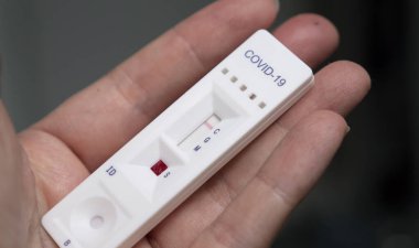 Covid-19 hızlı antikor test kiti 