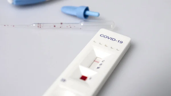 Covid Testkit Voor Het Detecteren Van Igm Igg Antilichamen Immuniteit — Stockfoto