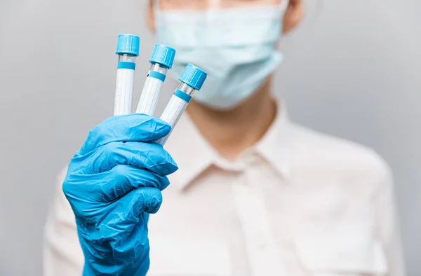 Κορίτσι Γιατρός σε ιατρική μάσκα και γάντια καουτσούκ, κρατά στα χέρια της, closeup του σωλήνα δοκιμής με δοκιμές για την παρουσία του covid-19. Γιατρός με ιατρικά ρούχα επιδεικνύει δοκιμαστικούς σωλήνες με coronavirus — Φωτογραφία Αρχείου