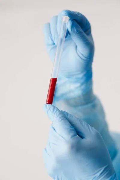 Kan örneğini tutan doktorun eline yaklaş. Tıbbi ekipman. Kan testi. COVID 19 Coronavirus enfeksiyonunu korumak için maske, gözlük ve giysi de dahil olmak üzere kişisel koruyucu ekipman giyen bir doktor..