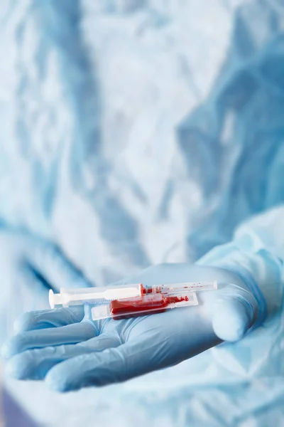 Close Doctor Hand Holding Syringe Blood Sample Medical Equipment Blood — Stock Photo, Image