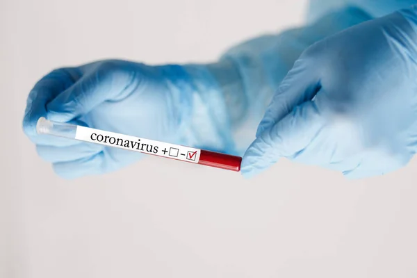 Kan örneğini tutan doktorun eline yaklaş. Tıbbi ekipman. Kan testi. COVID 19 Coronavirus enfeksiyonunu korumak için maske, gözlük ve giysi de dahil olmak üzere kişisel koruyucu ekipman giyen bir doktor..