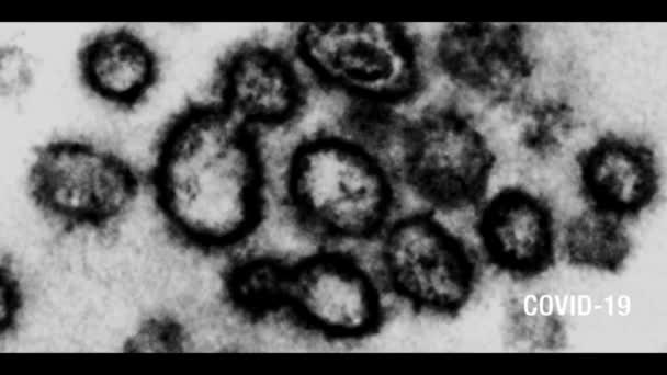 Coronavirus COVID-19 tekst og mikroskopbilde avslører med en svart og hvit, gammel TV-effekt med eksponeringsvridning og tekst nederst til høyre . – stockvideo