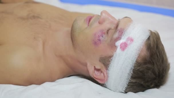 Muž s zranění hlavy ležící na posteli. ovázanou hlavu. modřiny na tváři. — Stock video
