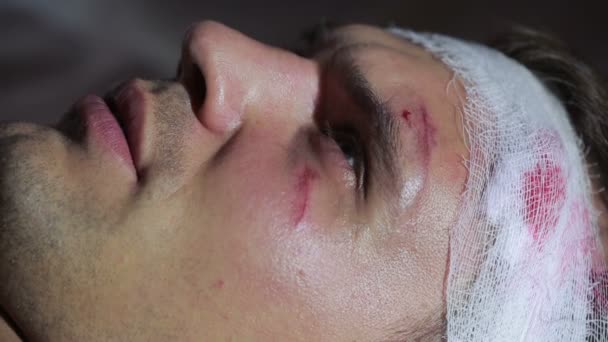 Férfi fejsérülések az ágyon. bepólyált feje. az arcán zúzódás. — Stock videók