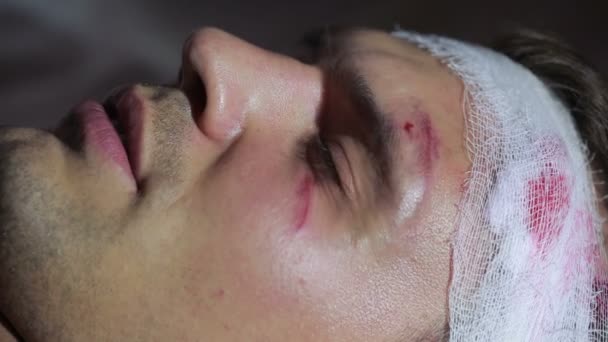 Άνδρα με τραύματα στο κεφάλι ξαπλωμένη στο κρεβάτι. επίδεσμο το κεφάλι. μελανιά στο πρόσωπό του. — Αρχείο Βίντεο