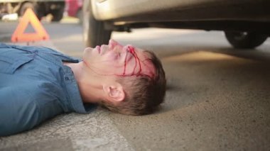 adam bir araba kazası geçirdi. Kafasını çarptı. yol kazaları yaralı yaya