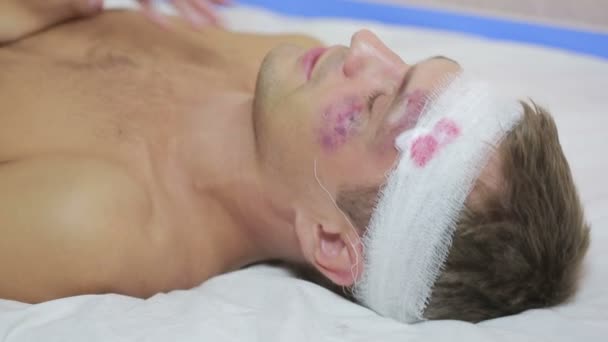 Muž s zranění hlavy ležící na posteli. ovázanou hlavu. modřiny na tváři. — Stock video