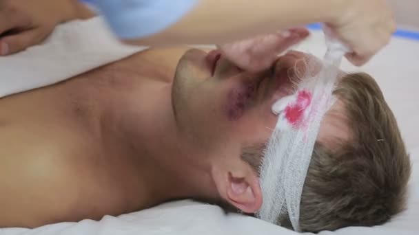 Infermiera fasciato testa bendaggio. un uomo ferito con lividi sul viso — Video Stock