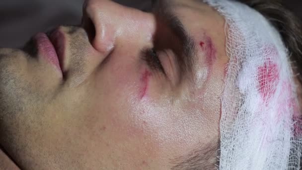 Man with head injuries lying on the bed. bandaged head. bruise on his face. — Stock Video