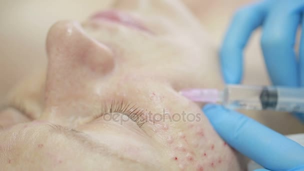 Trattamento cosmetico con iniezione in clinica. fortificazione della pelle — Video Stock