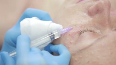 Kozmetik tedavi bir klinikte enjeksiyonlu. Cilt sur