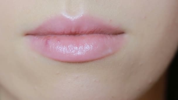 Mädchen berührt Wunden an den Lippen. Herpes. Lippenbehandlung, junge pralle Lippen — Stockvideo