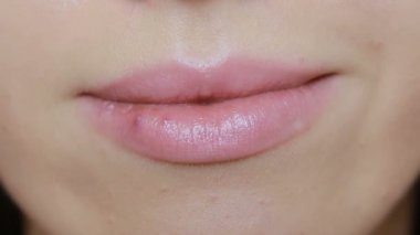 Kız dudaktan yaralar dokunarak. uçuk. tedavi, genç dolgun dudaklar dudak