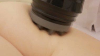 Kadın Kliniği lipomassage süren var. LPG