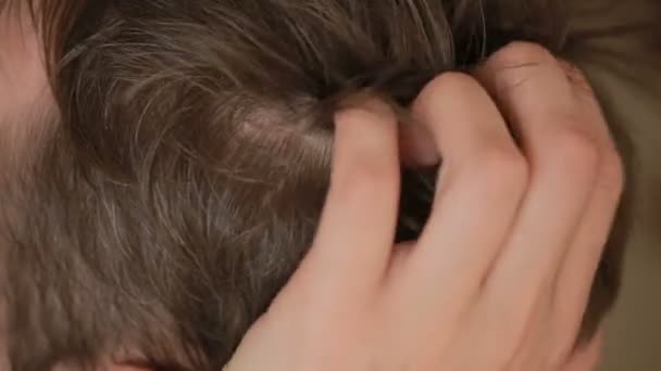 Лупа волосся на чоловіків, крупним планом, чоловік подряпає голову . — стокове відео