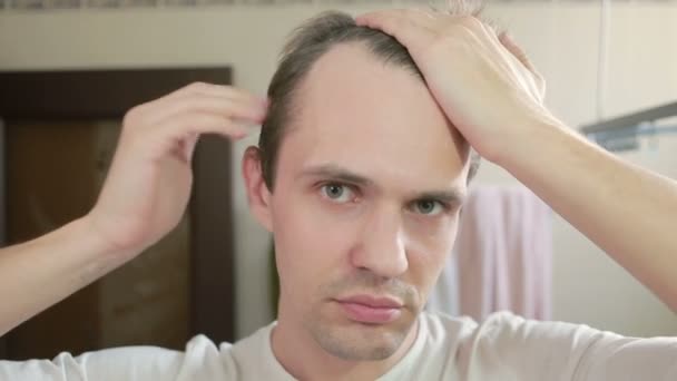 Homem atraente jovem inspeciona uma linha de cabelo recuando no banheiro. Calvície — Vídeo de Stock