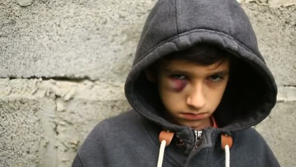 El niño es un adolescente con un hematoma y un ojo magullado que mira a la cámara . — Vídeos de Stock