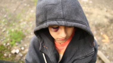 Çocuk bir hematom ve kameraya doğru görünüyor morarmış bir göz ile genç bir kız.