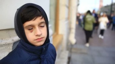 Çocuk bir hematom ve kameraya doğru görünüyor morarmış bir göz ile genç bir kız.