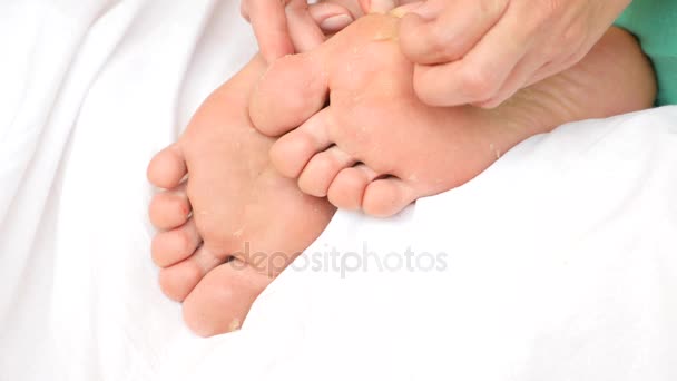Kobiece stopy z oderwanie skóry. Po zabiegu peeling do stóp. 4 k. zwolnionym tempie — Wideo stockowe