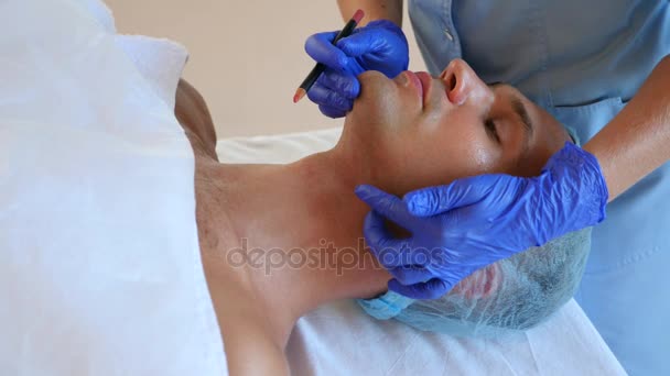美容师用铅笔使一个人的脸上的斑纹。整形手术。男人的轮廓脸塑料。4 k.缓慢射击. — 图库视频影像
