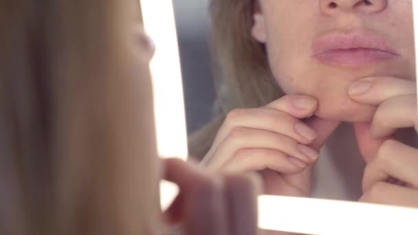 De vrouw de samendrukking van de acne, knijpt uit puistjes voor de spiegel. Close-up, 4k — Stockvideo