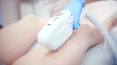 lazer epilasyon. Doktor eldiven. 4k, yakın çekim.