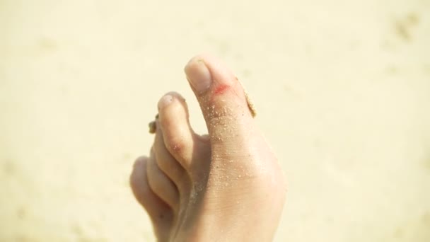 Fötter hud olycksrisken för blod på stranden — Stockvideo