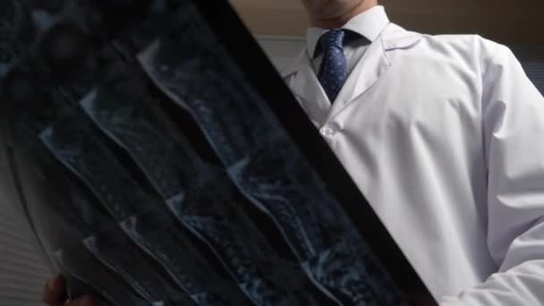 Perto. Ressonância magnética, radiografias. o médico analisa os resultados da terapia de ressonância magnética em filme. 4k — Vídeo de Stock