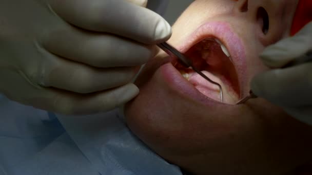 Gros plan. la femme rend visite au dentiste. mains de dentiste avec gants sur — Video