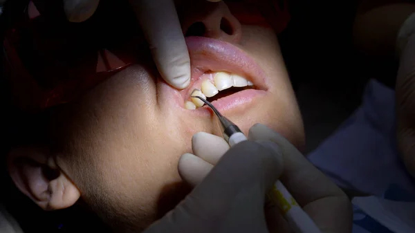 Zbliżenie. Kobieta odwiedza dentystę. ręce dentysty w rękawiczkach — Zdjęcie stockowe