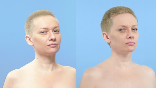 Potret seorang wanita. perbandingan sebelum dan sesudah rhinoplasty — Stok Video