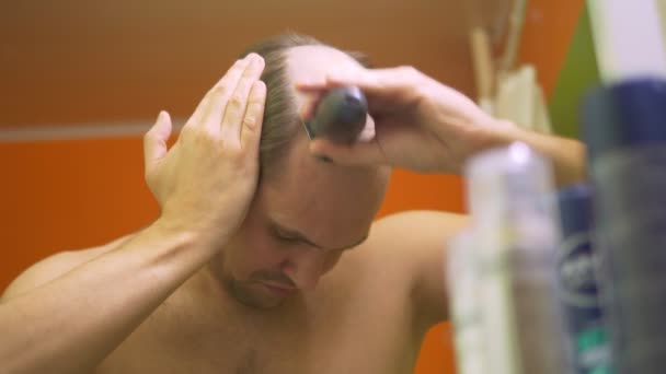 A casa, un uomo rasa il suo punto calvo davanti a uno specchio. problema di perdita dei capelli — Video Stock