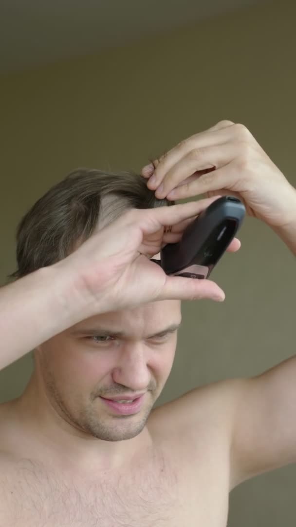 Κατακόρυφα. Ένας άντρας ξυρίζει τη φαλάκρα του μπροστά στον καθρέφτη. πρόβλημα τριχόπτωσης — Αρχείο Βίντεο