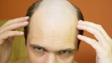 Kel bir adam saçını düzleştirir, banyo aynasına bakar. Yakın çekim