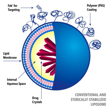 Geleneksel ve Sterically stabilize lipozom