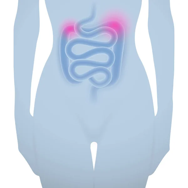 Silueta de mujer con intestino enfermo — Archivo Imágenes Vectoriales